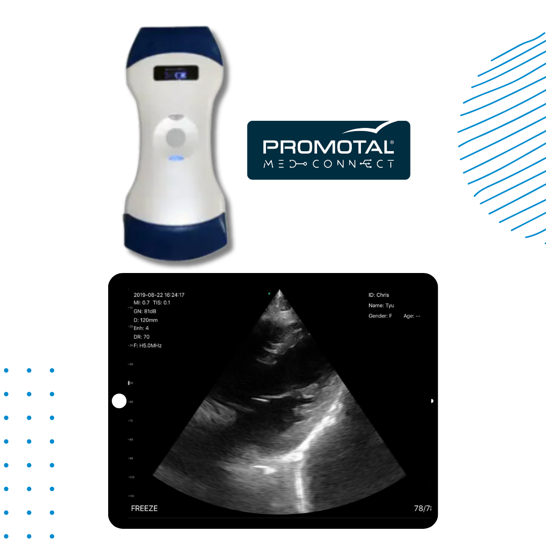 Échographe Ultra Portable Promotal MedConnect